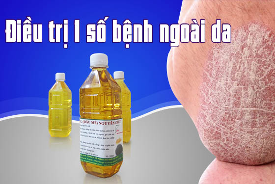 dầu mè chữa bệnh